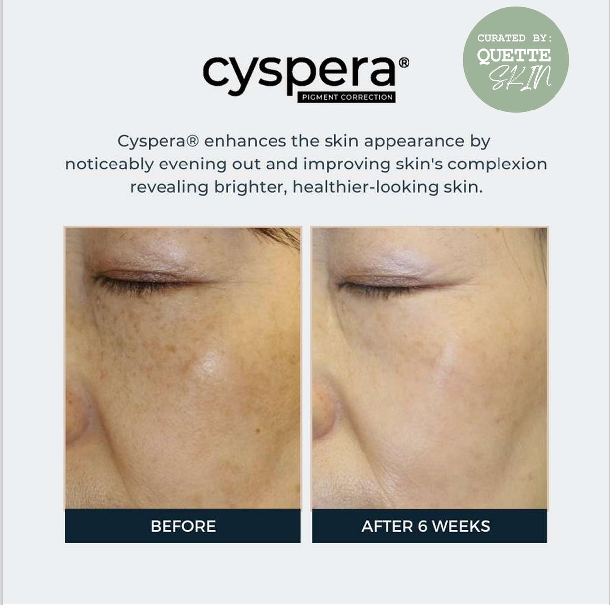 Cyspera Intensive Duo with 1.2% Retinol Cream